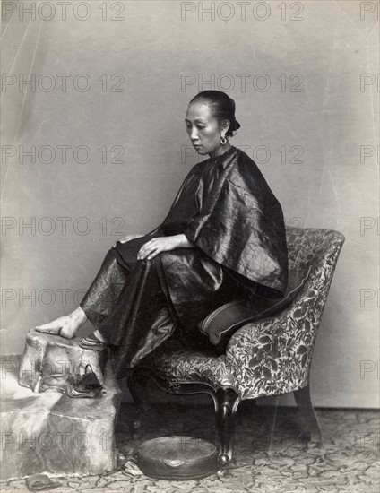 Chine, femme aux petits pieds bandés